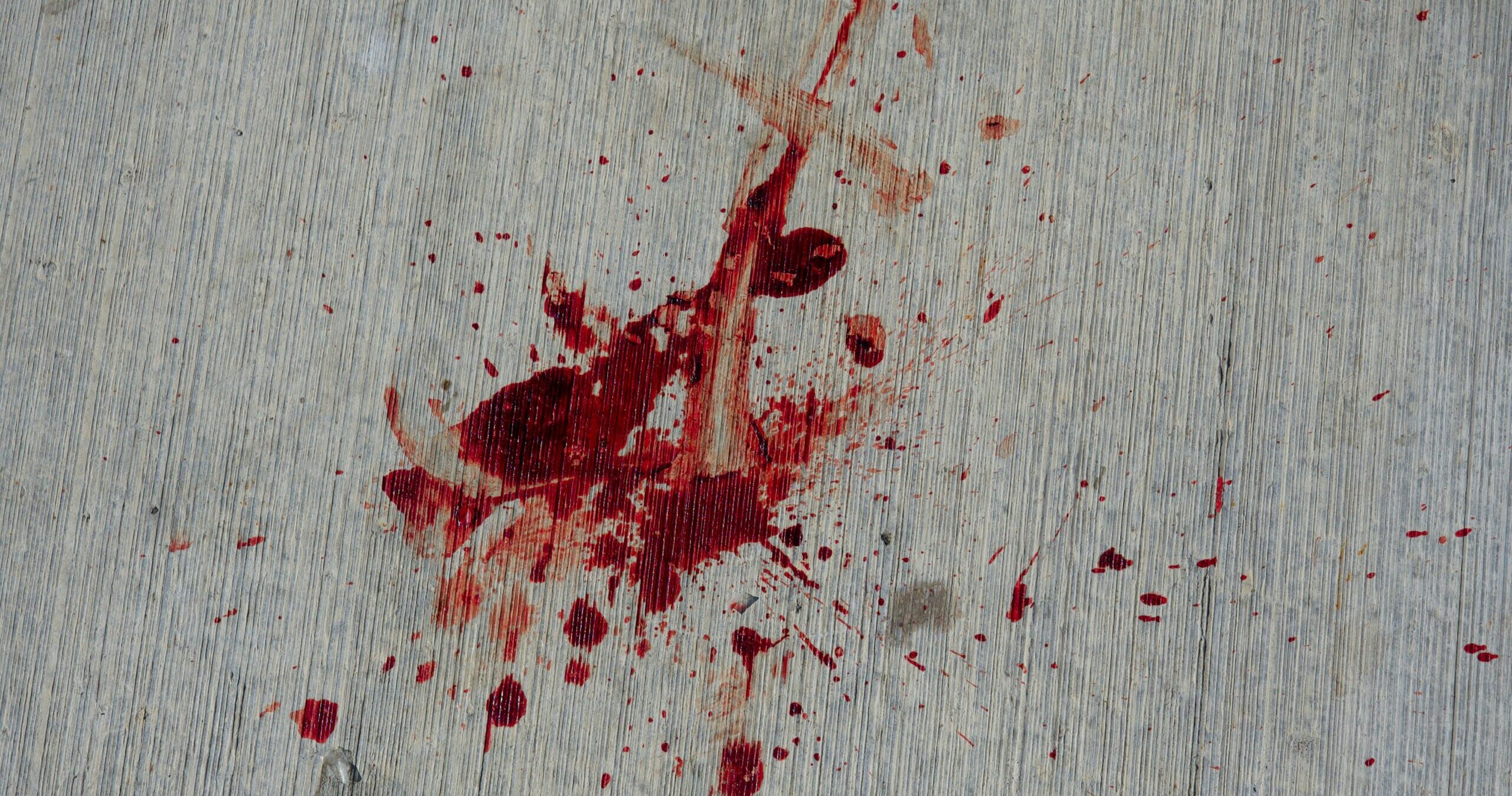 Ryzyko związane z&nbsp;kontaktem z&nbsp;płynami ustrojowymi i&nbsp;trupim jadem